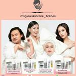 msglowskincare_brebes